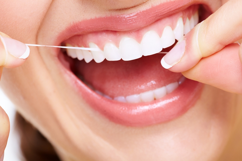 Even with beautiful veneers, your oral hygiene regime must be maintained.