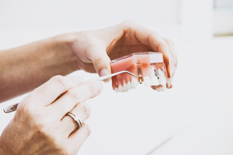 Discover the different roles within the dental industry today. 