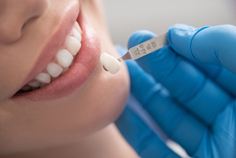 Ceramic crowns can closely mimic the appearance of real teeth.